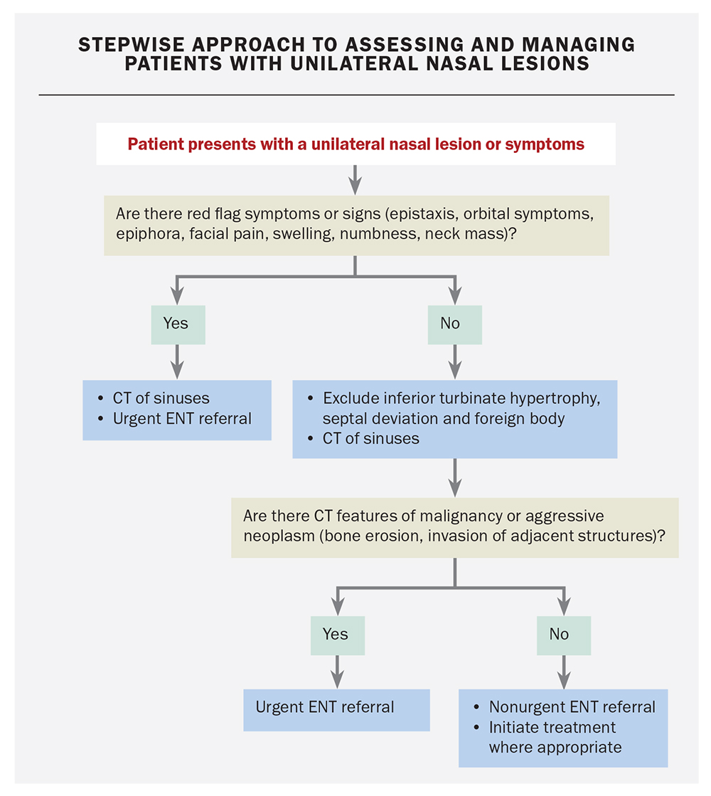 Unilateral nasal polyps and other sinonasal lesions benign or